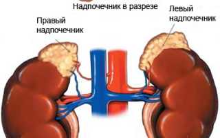 Причины, симптомы и лечение опухолей надпочечников