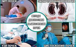 Этапы развития и характерные симптомы каликоэктазии почек: лечение и профилактика