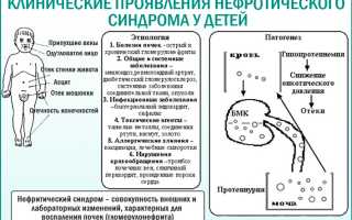 Причины возникновения нефротического синдрома у детей: диагностика и лечение