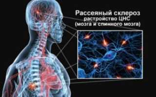 Нарушение иннервации мочевого пузыря